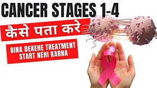 Cancer stages 14 in Hindi  Cancer stages explained [upl. by Aihsakal]