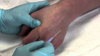 Intravenous Catheter Placement [upl. by Suiradel331]