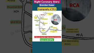 Right Coronary artery Branches l Angiography echo ecg shorts [upl. by Skell749]