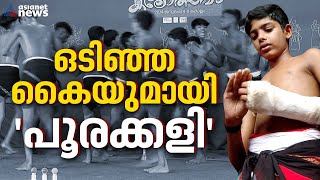 കൈ ഒടിഞ്ഞാലും ​ഗോപികൃഷ്ണന് പൂരക്കളി വിട്ടൊരു കളിയില്ല  Gopi Krishnan  Poorakali [upl. by Syman934]