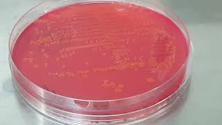 Colony characteristics of Escherichia coli on CLED Agar of Urine Culture [upl. by Aisena271]