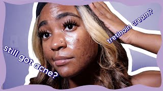 Tretinoin for Hormonal Acne 7 Month Update  My Skin Journey [upl. by Lennard860]