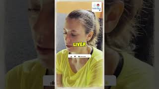 5 Natural Ways to Reverse Fatty Liver Disease Fast health healthylifestyle [upl. by Thenna435]