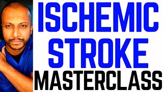 Secrets to Total Stroke Control  Outside Therapeutic Window [upl. by Dyob]