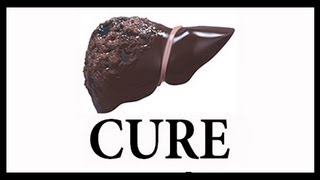 Part 1 of 5 LIVER CIRRHOSIS CURES  Natural Cure Treatment Remedy Liver Flush Protocol [upl. by Farmann]