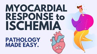 Myocardial Ischemia Pathology Simplified—Your Last Heart Attack [upl. by Aneleve]