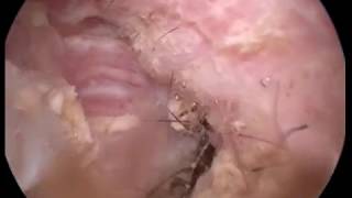 Ear wax cleaning in dog Otoscopy wwwendovetcom [upl. by Colvert34]