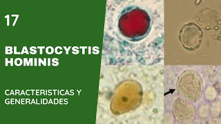 Blastocystis hominisquiste coproparasitologico [upl. by Abigale]