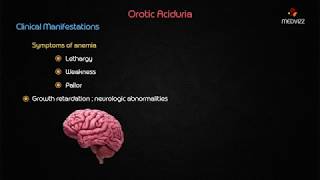 Orotic aciduria  Usmle biochemistry case based discussion [upl. by Nehr]