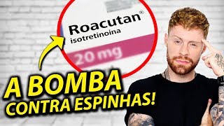 ROACUTAN Minha Experiência com o Tratamento para Espinhas funciona MESMO [upl. by Einaoj]