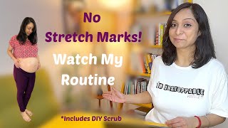 How I Prevented 90 Stretch Marks During Pregnancy Tips amp Tricks That Actually Work [upl. by Aowda]