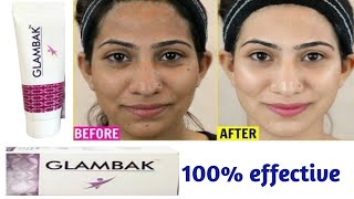 Glambak cream review  Kojic acid cream  सबसे अच्छी बिना किसी नुकसान के गोरा होने की क्रीम glambak [upl. by Currey]