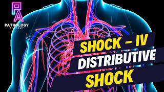 Understanding Distributive Shock  By Dr Aditi Kumar [upl. by Desiree481]