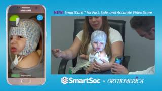 SmartSoc® SmartCam™ for Fast Safe and Accurate Video Scans [upl. by Mitzl]