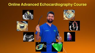 CIC Online Advanced Echocardiography Course [upl. by Nannette]