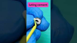 DENTIST Shares Top Crown Preparation Techniques shorts [upl. by Abate809]