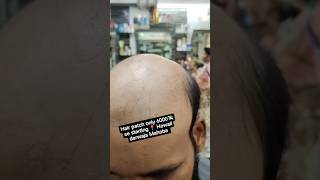 Hair patch hairstyle viralvideo youtuber hairsaloon hairpatch shorts [upl. by Roley226]