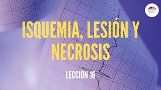 16 ELECTOCARDIOGRAMA ISQUEMIA LESIÓN Y NECROSIS ELECTROCARDIOGRAFÍA [upl. by Alikam]