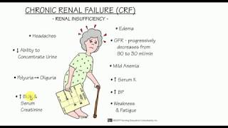 Chronic Renal Failure  MEDICINE Lectures  NEPHROLOGY  TP 6 [upl. by Acenom]