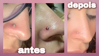 COMO CUIDAR DO PIERCING INFLAMADO  tchau queloide [upl. by Ehtylb156]