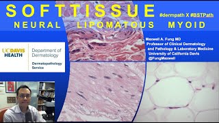 DERMATOPATHOLOGY Soft Tissue Tumors Neural Lipomatous Myoid [upl. by Ingar]