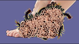 ASMR removal creepy crawlies infested leg Asmr Animation treatment removal worms amp Scoprion [upl. by Mar700]