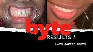 BYTE ALIGNERS FINAL RESULTS REVIEW  GAPPED TEETH  Before and After Pictures [upl. by Sakiv]