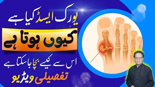 URIC ACID  Kya hai Kyun Hota Hai  Best Remedy  Details Video about URIC ACID  ILAJ Kaysa Karain [upl. by Terpstra371]