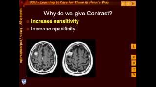 Introduction to Contrast Enhancement [upl. by Oribelle]