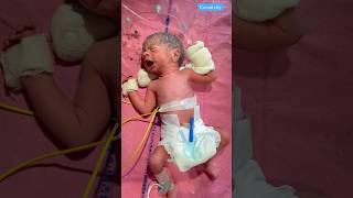 Cute Newborn Crying medical viralvideo [upl. by Muhcon]