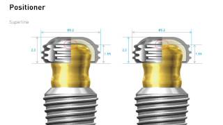 2D Manual Overdenture System [upl. by Ymer855]