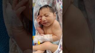 23 kg female child delivered with microcephaly 😍♥️viral shortvideo youtubeshorts [upl. by Fabrice]