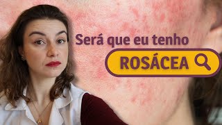 5 dicas para pele com rosácea  Dica de Esteticista [upl. by Zile]