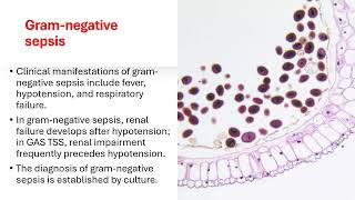 STREPTOCOCCAL TOXIC SHOCK SYNDROME  Streptokokal toksik Şok Sendromu [upl. by Renrew]