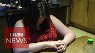 Narcolepsy What is it like to have a cataplexy attack  BBC News [upl. by Sillyhp559]