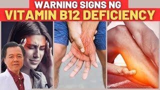 9 Warning Signs na Kulang Ka sa Vitamin B12  By Doc Willie Ong [upl. by Anoif]