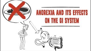 How anorexia affects the digestive system [upl. by Eisus]