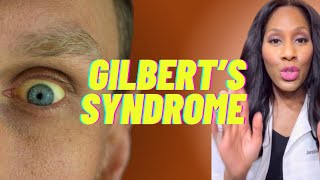 What is Gilbert’s Syndrome What Are the Symptoms of Gilbert’s Syndrome A Doctor Explains [upl. by Gahan402]