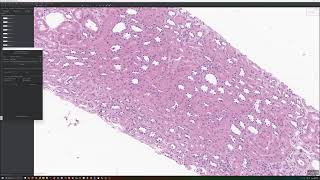 Annotate Glomeruli and Tubules using QuPath and Segment Anything Plugin [upl. by Eugine]