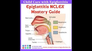 Epiglottitis For NCLEX epiglottitis education nursingexam nclexquestions nclexpreparation eaxm [upl. by Keenan]