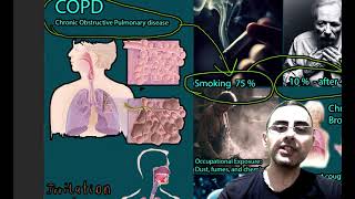 COPD Chronic Bronchitis and Emphysema  Symptoms Causes and treatment [upl. by Goulder]