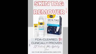 Best Skin Tag Removal shortsvideos skintagremoval skincare [upl. by Yduj357]