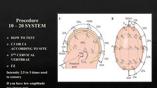 Median Somatosensory evoked potentials Part 1 [upl. by Kendy677]