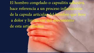 Hombro Congelado  Capsulitis Adhesiva [upl. by Yreved960]