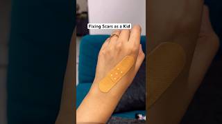 Fixing scars as a kid 🤌🏻 shorts youtubeshorts ytshort [upl. by Mis268]