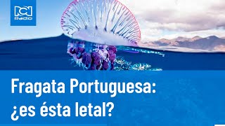 Fragata Portuguesa ¿es letal su picadura RCN Radio [upl. by Jed993]