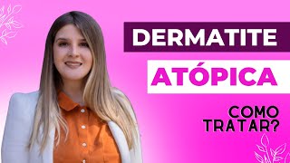 DERMATITE ATÓPICA  Como tratar e aliviar os sintomas dermatite dermatologia [upl. by Cindi]