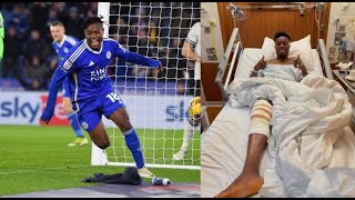 🚨🇬🇭BREAKINGFATAWU ISSAHAKU COMPLETES ACL SURGERY SET TO BE OUT FOR LONG SPELLDETAILS [upl. by Razec]