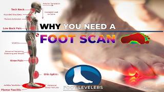 Correcting pronation leads to whole body health benefits Why you need a foot scan [upl. by Alexina292]