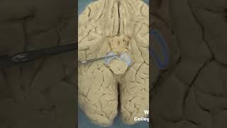 Interpeduncular fossa neuroanatomy brainstembrainWCUCOM Neuroscience [upl. by Silva572]